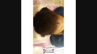 اسکالپ برای چه آقایانی مناسب هست؟؟؟؟