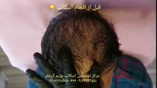 اسکالپ آقایان