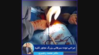 فیلم جراحی توده سرطانی بزرگ مجاور کلیه دکتر محمد رنجبری