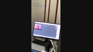 درمان عفونت واژینال با کلپوسکوپى