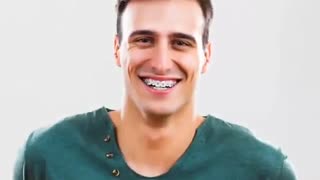 بنظرتون ارتودنسی تا چه سنی امکان پذیره؟ | دکتر سعید قریشی
