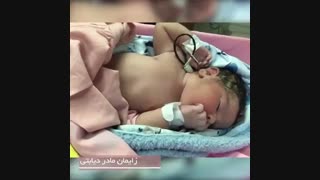 فیلم زایمان مادر دیابتی