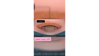 فیلم زایمان سزارین