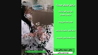 فیلم مزایای فیشیال برداشتن زگیل