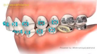 کرونا و ارتودنسی | دکتر سپیده دادگر