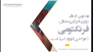 نوار بافتی کوچکی که لب بالا را به لثه متصل میکند، فرنوم نام دارد | دکتر سپیده دادگر