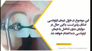 آیا در طول درمان ارتودنسی امکان انجام درمانهای دندانپزشکی وجود دارد؟ | دکتر سیده دادگر