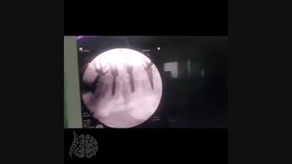 فیلم جراحی ستون فقرات
