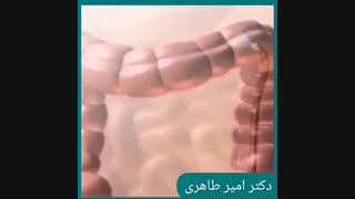 انیمیشن کولونوسکوپی