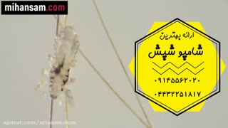 نحوه تخمگذاری شپش ها | دفع کامل تخم شپش با شامپو تخصصی