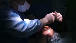 عمل تعویض مفصل زانو