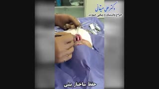 فیلم حفظ ساختار بینی