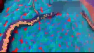 نحوه تاثیر دارو های شیمی درمانی در افراد مبتلا به سرطان