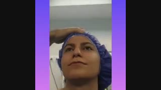 فیلم واقعی از جراحی قوز بینی و مدل نیمه فانتزی