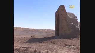 همسفر - فردوس - 3 تزریق ژل