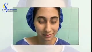 نمونه جراحی زیبایی بینی