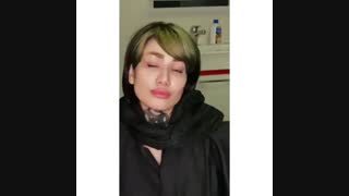 فیلم نمونه واقعی جراحی ترمیمی ببنی، جراحی سانترال لب و بلفاروپلاستی