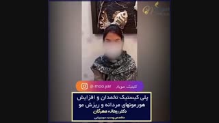 تخمدان پلی کیستیک و افزایش هورمون های مردانه و ریزش مو