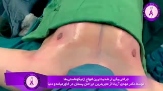 جراحی یکی از شدیدترین انواع ژنیکوماستی‌ ها