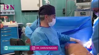 جراحی زیبایی شکم و سینه