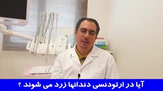 آیا در ارتودنسی دندانها زرد می شوند؟ | دکتر احسان مهریزی