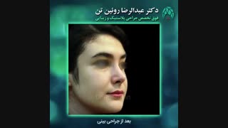 جراحی بینی | فوق تخصص جراحی پلاستیک | دکتر عبدالرضا روئین تن
