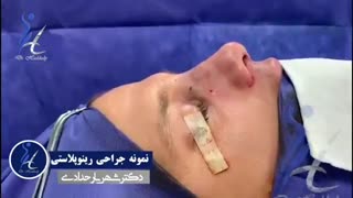 جراحی زیبایی بینی