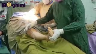 عمل جراحی تعویض مفصل زانو در خانم ۷۰ ساله با درد و لنگش و دفرمیتی شدید زانو