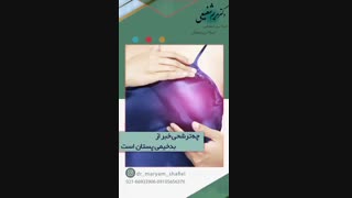 چه ترشحاتی خبر از بدخیمی پستان دارد؟