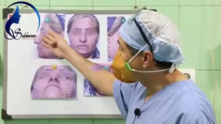 فیلم جراحی رینوپلاستی در بینی های گوشتی