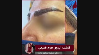 فیلم نمونه واقعی کاشت ابروی طبیعی