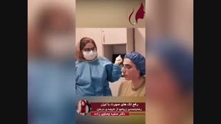 فیلم رضایت از نتیجه رفع لک های صورت با لیزر