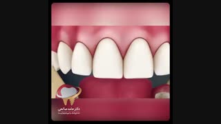 یکی از ابزارهای مهم برای رعایت بهداشت دهان و دندان مسواک است | دکتر حامد صالحی