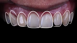 یک اقدام موثر در کسب نتیجه ایده‌آل | دکتر حامد صالحی