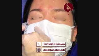 فیلم واقعی تزریق بوتاکس پوسیدگی دندان