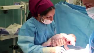 فیلم روند زایمان سزارین