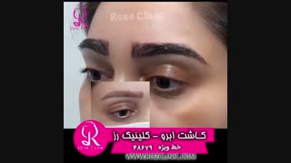 فیلم کاشت ابرو | کلینیک رز | 02148679 | شماره 219