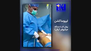 فیلم لیپوساکشن