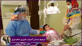 ترمیم دندان آسیای شیری سام عزیز توسط دکتر اذرنوش