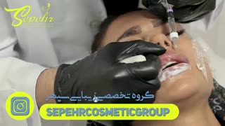 فیلم مراحل تزریق ژل به لب خانمی جوان