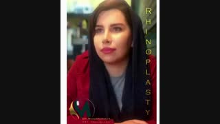 هفت ماه پس از جراحی زیبایی بینی توسط دکتر مختاری فر