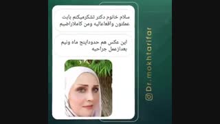 پنج ماه و نیم پس از جراحی زیبایی بینی توسط دکتر مختاری فر