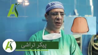 فرق ابدومینوپلاستی و لیپوساکشن