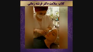 فیلر زیر چشم مدل زیبای ما