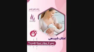 آیا امکان شیردهی پس از جراحی پروتز سینه وجود دارد؟