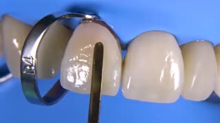 چگونه دندان هایی زیبا داشته باشیم؟