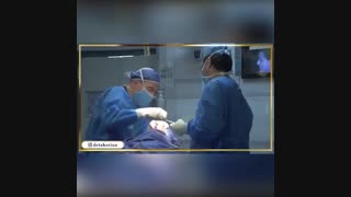 فیلم جراحی سپتورینوپلاستی