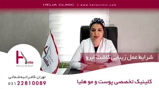 شرایط عمل زیبایی کاشت ابرو | کلینیک هلیا | 09120687738