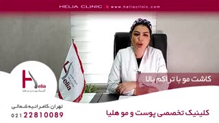 کاشت مو با تراکم بالا | کلینیک هلیا | 09120687738