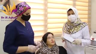 فیلم تزریق ژل و تغییر فک